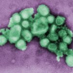 A digitally colorized CDC electron micrograph of influenza A(H1N1) virus particles from 2009. Archive image; not a specimen from the current flu season.