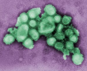 A digitally colorized CDC electron micrograph of influenza A(H1N1) virus particles from 2009. Archive image; not a specimen from the current flu season.