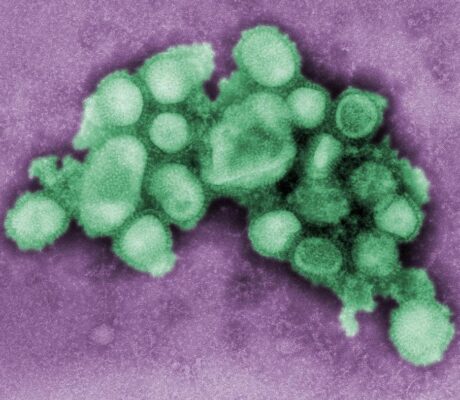 A digitally colorized CDC electron micrograph of influenza A(H1N1) virus particles from 2009. Archive image; not a specimen from the current flu season.