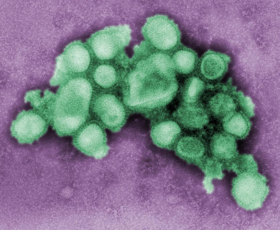 A digitally colorized CDC electron micrograph of influenza A(H1N1) virus particles from 2009. Archive image; not a specimen from the current flu season.