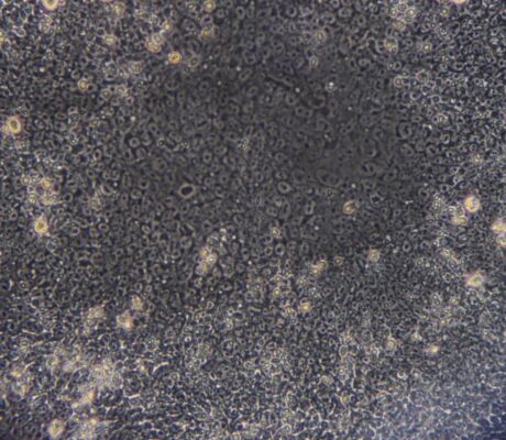 Induced pluripotent stem cells at MIRAI EXPO Kobe in March2015. Archive, not AMCHEPRY cells or transplant.