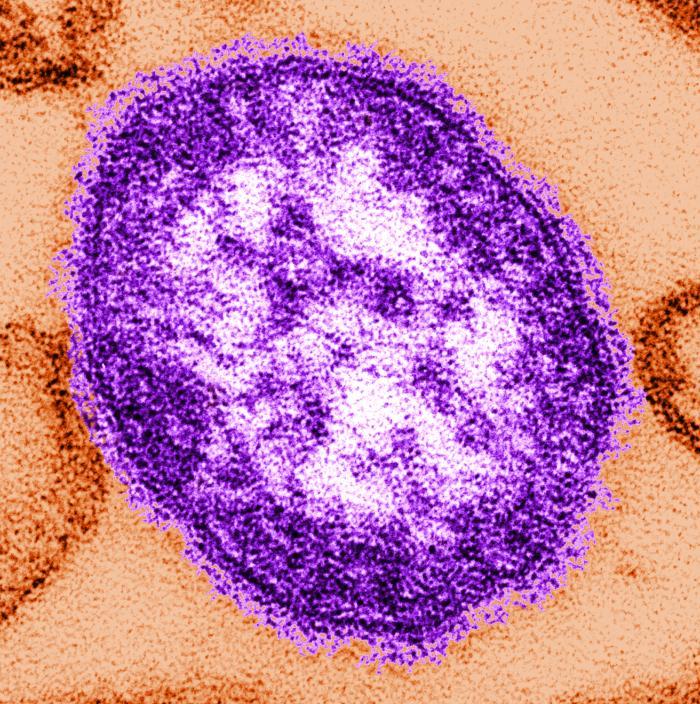 Digitally colorized transmission electron micrograph of a measles virus particle.