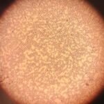 Archive micrograph of red blood cells, April2024, not a Casgevy patient or treatment image.